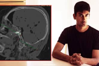 Suchir Balaji Toxicology And Radiology Report Published By Family.
