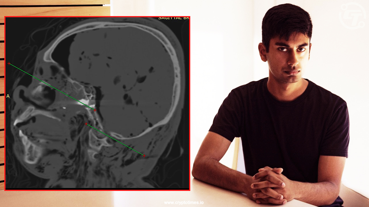 Suchir Balaji Toxicology And Radiology Report Published By Family.